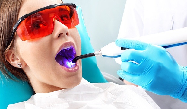 Little girl receiving dental selants