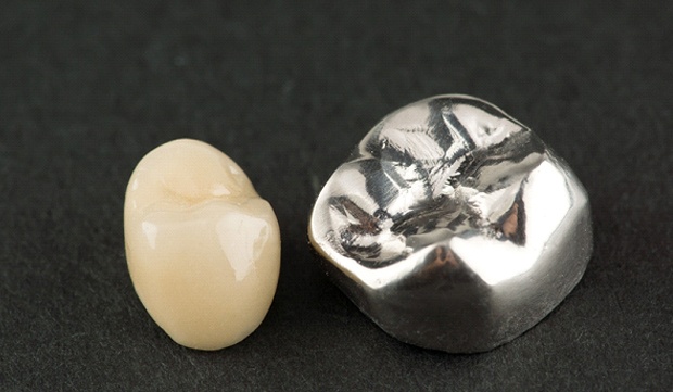 a metal-free dental crown sitting next to a metal dental crown