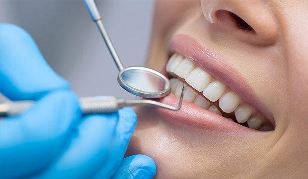 Closeup of smile during dental exam