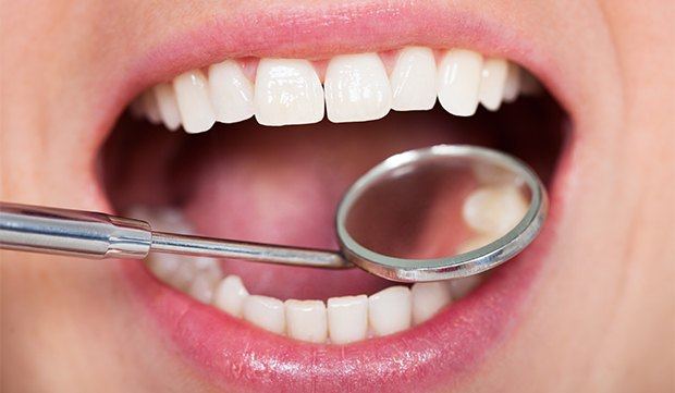 Closeup of smile during dental exam