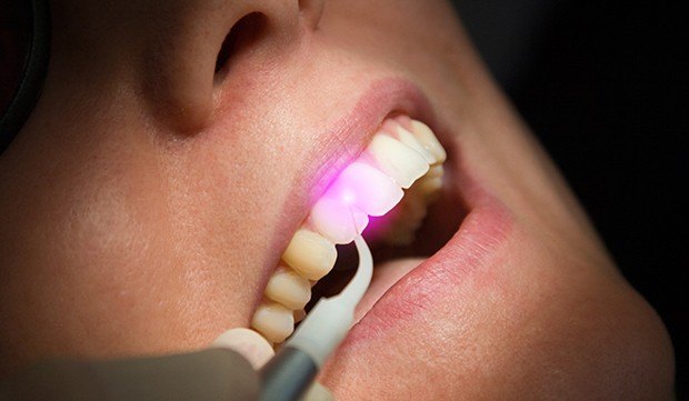 Patient receiving laser dentistry