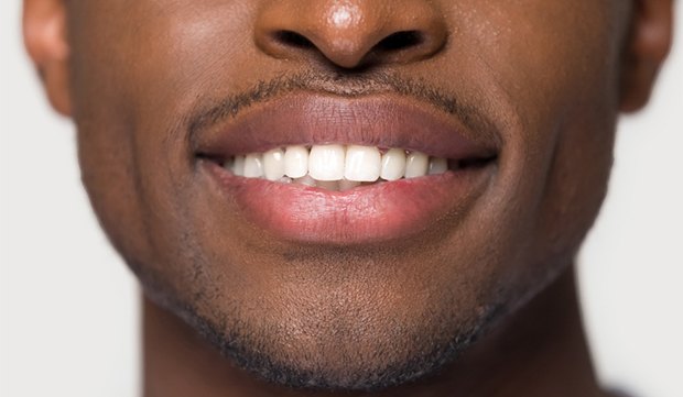 A person with an even, healthy smile